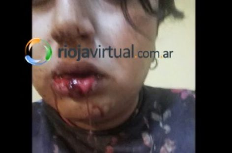 Lo golpearon salvajemente simplemente por ser gay