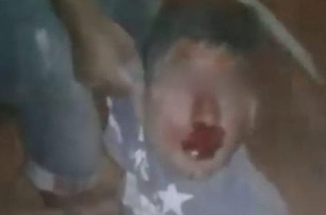 Le robó un celular a un niño y fue linchado por vecinos