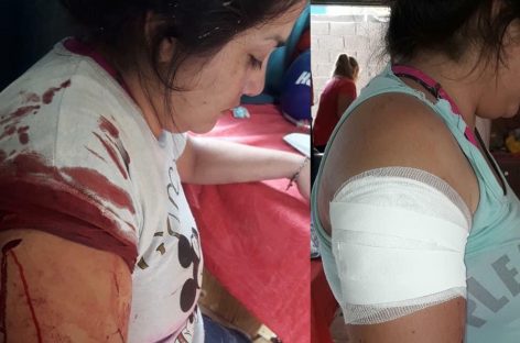 Violencia extrema. Denunció que fue apuñalada por su ex pareja