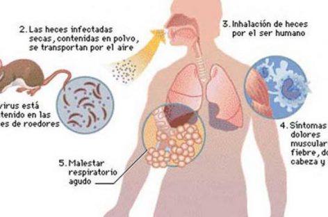 Descartan casos de hantavirus en territorio riojano