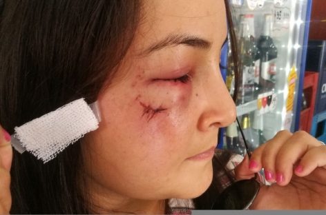 Violencia extrema. No le vendió una cerveza y le dio un botellazo
