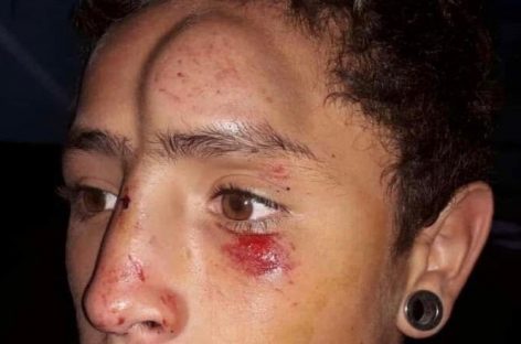 Menor salvajemente golpeado por circular en bici por la vereda