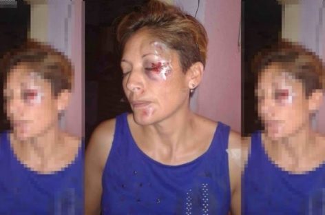 Inseguridad extrema. Motochorros y otro salvaje ataque a una mujer