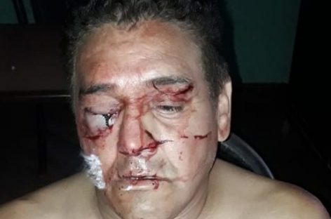 Fue agredido brutalmente y perdió un ojo: dos detenidos