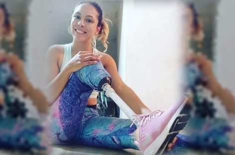 Celeste Díaz: un grave accidente le cambió la vida, lo superó y hasta perdonó