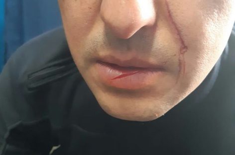 Delincuente se resistió a ser detenido e hirió a cuatro policías