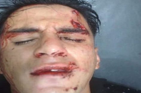Inseguridad extrema. Lo golpearon salvajemente para robarle el celular