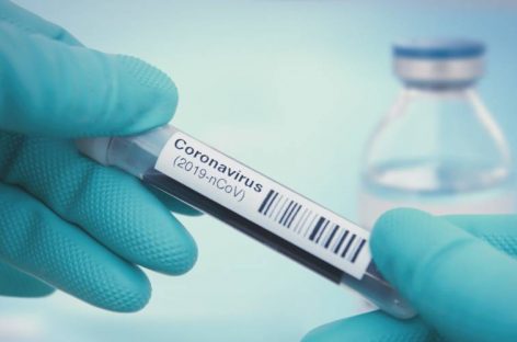 EL MIÉRCOLES INICIAN LOS ANÁLISIS DE CORONAVIRUS EN LA RIOJA
