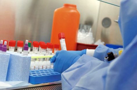 SALTA. CONFIRMAN CASOS DE CORONADENGUE