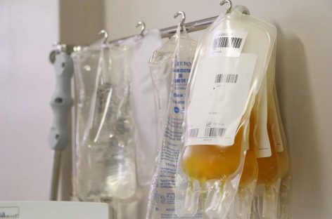 PREOCUPACIÓN POR LA DRÁSTICA MERMA EN DONACIÓN DE PLASMA
