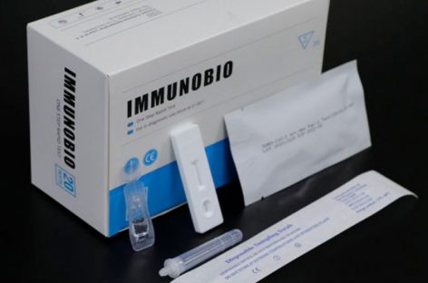 COVID. YA SE VENDEN EN FARMACIAS DE TODO EL PAÍS LOS AUTOTEST  A $1650