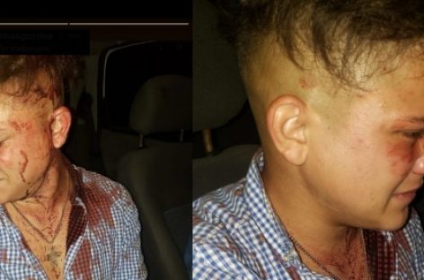 FEROZ GOLPIZA A UN JOVEN A LA SALIDA DE UNA FIESTA PRIVADA