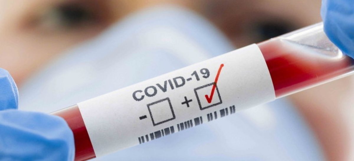 SIGUEN EN DESCENSO LOS CASOS ACTIVOS DE COVID 19
