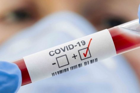SIGUEN EN DESCENSO LOS CASOS ACTIVOS DE COVID 19