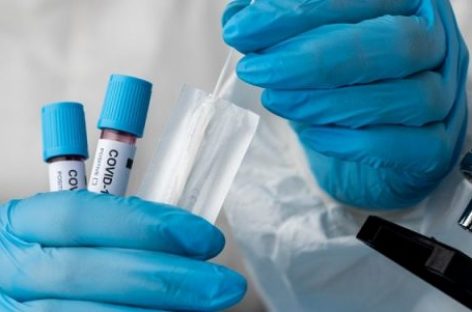 COVID. EN LA ÚLTIMA SEMANA CAYERON UN 55,7% LA CANTIDAD DE CASOS ACTIVOS