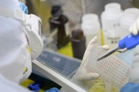 BIOQUIMICOS ALERTAN POR FALTANTES DE REACTIVOS E INSUMOS POR LAS NUBES