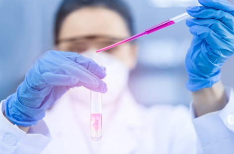 COMPLEJA SITUACIÓN EN LABORATORIOS POR LA FALTA Y LA SUBA DE INSUMOS