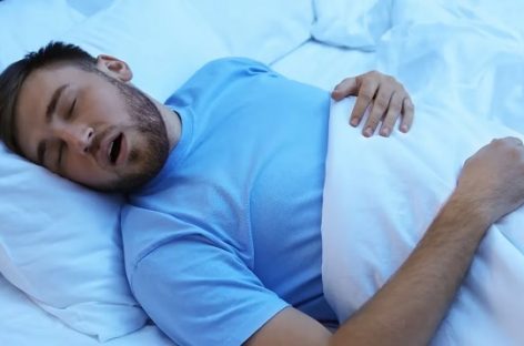 APNEA DEL SUEÑO. QUÉ ES Y CUÁL ES SU RELACIÓN CON LA OBESIDAD