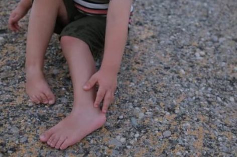 ¿CÓMO IMPACTA EL VIRUS DEL DENGUE EN LAS INFANCIAS?