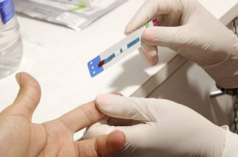 REALIZARÁN UNA JORNADA DE TESTEOS RÁPIDOS PARA DETECCIÓN DEL HIV