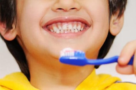 FLUOROSIS DENTAL. QUÉ ES, COMO EVITARLA Y QUÉ TRATAMIENTO HACER SI SE LA TIENE